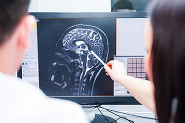 brain injury attorney los angeles